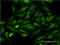 Cyclin Dependent Kinase 9 antibody, LS-C196884, Lifespan Biosciences, Immunofluorescence image 