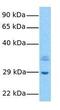 Ribosomal Protein Lateral Stalk Subunit P0 antibody, GTX47426, GeneTex, Western Blot image 