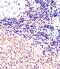 Polycomb protein SUZ12 antibody, PA5-72232, Invitrogen Antibodies, Immunohistochemistry frozen image 