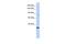 AHNAK Nucleoprotein 2 antibody, A09243, Boster Biological Technology, Western Blot image 