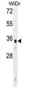 WD Repeat Domain 5B antibody, AP54551PU-N, Origene, Western Blot image 