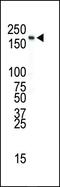 Insulin Receptor antibody, PA5-14687, Invitrogen Antibodies, Western Blot image 