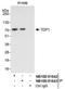 Tyrosyl-DNA Phosphodiesterase 1 antibody, NB100-81643, Novus Biologicals, Western Blot image 