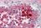 Clusterin antibody, orb19080, Biorbyt, Immunohistochemistry paraffin image 