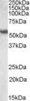 Keratin 13 antibody, PA5-19049, Invitrogen Antibodies, Western Blot image 