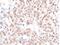 Chromatin Assembly Factor 1 Subunit A antibody, NB100-74609, Novus Biologicals, Immunohistochemistry paraffin image 