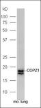 Coatomer Protein Complex Subunit Zeta 1 antibody, orb182669, Biorbyt, Western Blot image 