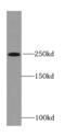Ryanodine Receptor 2 antibody, FNab07546, FineTest, Western Blot image 