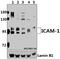Intercellular Adhesion Molecule 1 antibody, GTX66707, GeneTex, Western Blot image 