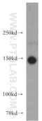 TAO Kinase 2 antibody, 21188-1-AP, Proteintech Group, Western Blot image 