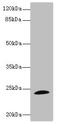 TPPP antibody, LS-C676628, Lifespan Biosciences, Western Blot image 