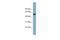 Family With Sequence Similarity 83 Member E antibody, A17466, Boster Biological Technology, Western Blot image 