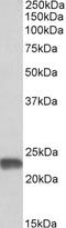 Superoxide Dismutase 2 antibody, STJ72598, St John