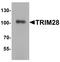 Tripartite Motif Containing 28 antibody, LS-B10061, Lifespan Biosciences, Western Blot image 