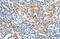 Solute carrier family 22 member 3 antibody, ARP44026_P050, Aviva Systems Biology, Immunohistochemistry paraffin image 