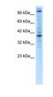 Zinc Finger Protein 624 antibody, NBP1-80015, Novus Biologicals, Western Blot image 
