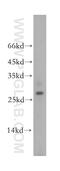 Biphenyl Hydrolase Like antibody, 17974-1-AP, Proteintech Group, Western Blot image 