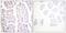Component Of Inhibitor Of Nuclear Factor Kappa B Kinase Complex antibody, PA5-38255, Invitrogen Antibodies, Immunohistochemistry paraffin image 