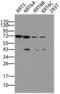 Keratin 5 antibody, LS-B12241, Lifespan Biosciences, Western Blot image 