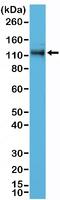 Catenin Delta 1 antibody, NBP2-77423, Novus Biologicals, Western Blot image 