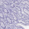 Keratin 6B antibody, HPA045697, Atlas Antibodies, Immunohistochemistry paraffin image 