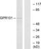 G Protein-Coupled Receptor 101 antibody, TA315875, Origene, Western Blot image 