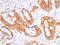 Mucin 1, Cell Surface Associated antibody, NBP2-44665, Novus Biologicals, Immunohistochemistry paraffin image 