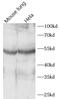 Acyl-CoA Oxidase Like antibody, FNab10428, FineTest, Western Blot image 