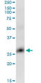 GLI Pathogenesis Related 1 antibody, LS-C139201, Lifespan Biosciences, Western Blot image 