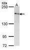 Rho Associated Coiled-Coil Containing Protein Kinase 2 antibody, PA5-28774, Invitrogen Antibodies, Western Blot image 
