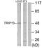 Thyroid Hormone Receptor Interactor 13 antibody, TA314893, Origene, Western Blot image 