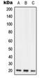 Regulator Of G Protein Signaling 10 antibody, LS-C352773, Lifespan Biosciences, Western Blot image 