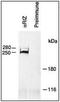 PR/SET Domain 2 antibody, PA1-31782, Invitrogen Antibodies, Immunoprecipitation image 
