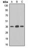 Methionine Adenosyltransferase 2B antibody, LS-C668433, Lifespan Biosciences, Western Blot image 