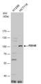 Phosphodiesterase 4B antibody, PA5-21460, Invitrogen Antibodies, Western Blot image 