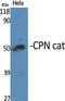 Carboxypeptidase N Subunit 1 antibody, A05704, Boster Biological Technology, Western Blot image 