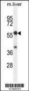 TBCC Domain Containing 1 antibody, 55-267, ProSci, Western Blot image 
