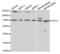 Glypican 3 antibody, abx001589, Abbexa, Western Blot image 