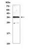 Mediator Complex Subunit 4 antibody, A06467-1, Boster Biological Technology, Western Blot image 