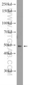 Cbl Proto-Oncogene Like 2 antibody, 25600-1-AP, Proteintech Group, Western Blot image 