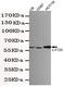 Fos Proto-Oncogene, AP-1 Transcription Factor Subunit antibody, STJ99211, St John