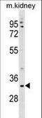 Transmembrane Protein 178A antibody, LS-C157215, Lifespan Biosciences, Western Blot image 