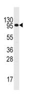 Colony Stimulating Factor 2 Receptor Beta Common Subunit antibody, abx032814, Abbexa, Western Blot image 