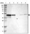 Protein NDRG3 antibody, NBP1-86046, Novus Biologicals, Western Blot image 