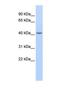 Epithelial Stromal Interaction 1 antibody, NBP1-69247, Novus Biologicals, Western Blot image 