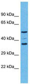 Olfactory Receptor Family 5 Subfamily K Member 4 antibody, TA337531, Origene, Western Blot image 