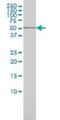 Alpha-L-Fucosidase 1 antibody, H00002517-M01, Novus Biologicals, Western Blot image 