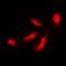 ST3 Beta-Galactoside Alpha-2,3-Sialyltransferase 3 antibody, orb215519, Biorbyt, Immunocytochemistry image 