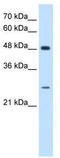 SH3 Domain Binding Glutamate Rich Protein antibody, TA338902, Origene, Western Blot image 