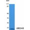 Ubiquitin Conjugating Enzyme E2 A antibody, LS-C386837, Lifespan Biosciences, Western Blot image 